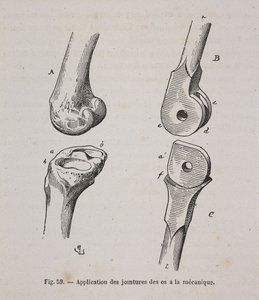 Historische Zeichnung eines menschlichen Kniegelenks und daneben einer Prothese dazu.
