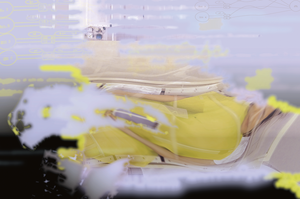 distorted image of a person lying in bed